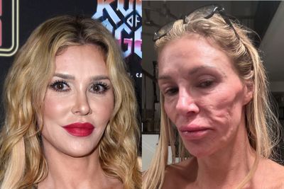 Brandi Glanville rushed to hospital amid health issues after being unable to move her head and neck