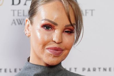 Katie Piper forced to make heartbreaking decision after ‘unexpected’ eye surgery