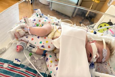 ‘Not out of the woods by any means’: Newborn fights for life after circumcision ‘gone awry’ nearly kills him
