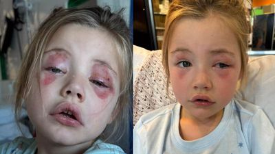 Girl Blinded After Biting Persil Pod as Furious Mom Slams 'Inadequate' Warnings