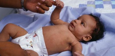 Whooping cough is making a comeback, but the vaccine provides powerful protection