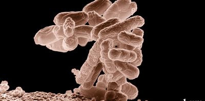 IBS and Sibo have overlapping symptoms – here’s what you need to know about these different digestive conditions