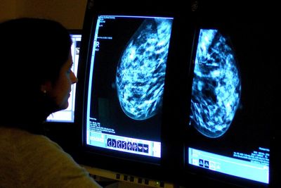 The only way to spot the earliest warning sign of cancer
