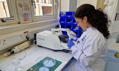 Scientists use live human brain tissue to speed up hunt for dementia cure