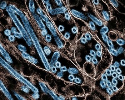 H5N1 Bird Flu Threat: Experts Sound Alarm Over Potential Pandemic As Infections Spread To All 50 US States