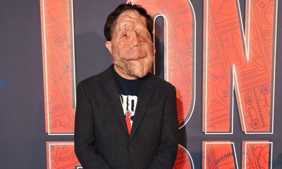 A Different Man’s Adam Pearson to star in new film of The Elephant Man
