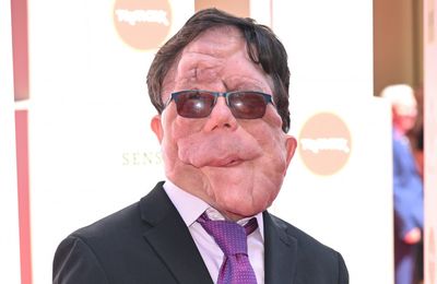 Adam Pearson 'beyond honoured' to star in Elephant Man remake