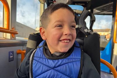 ‘Life-changing’ results for children with severe epilepsy in pioneering drug trial