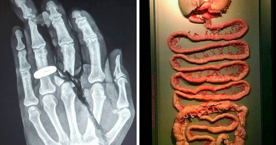 70 Medical Pics That Prove The Body Keeps The Score, And Sometimes It’s Absolutely Terrifying