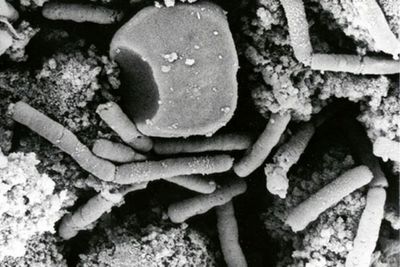 Thailand reports anthrax death as public health alert issued for outbreak