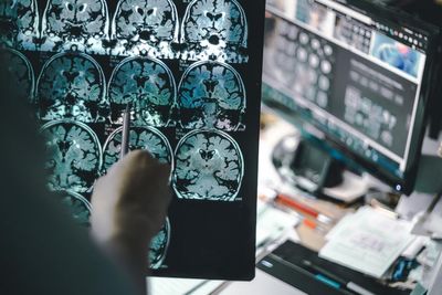 There are specific brain cells that enable intelligent behaviour, scientists say