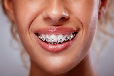 What causes gums to recede – and how to fix it