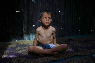 AP PHOTOS: Many in Gaza face malnutrition and hunger as blockade enters its third month