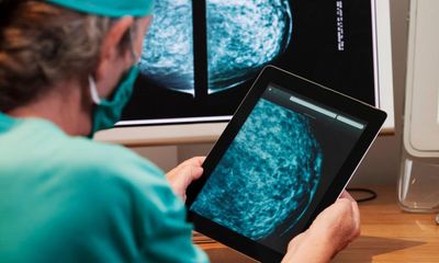NHS England aims for faster cancer treatment with new data tool