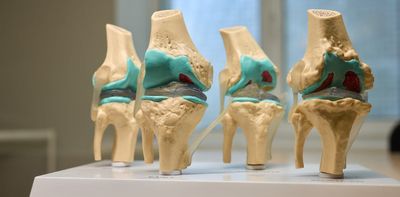 What are the key risk factors for developing knee osteoarthritis? We reviewed the evidence