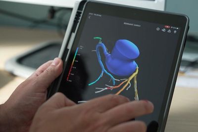 3D heart scans have saved NHS millions since 2021 rollout, data shows