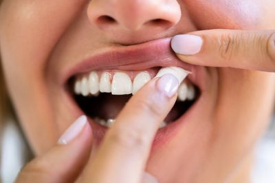 Crackdown on snus-style nicotine pouches in ‘smokefree generation’ law
