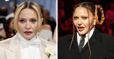 66YO Madonna Brings Back Natural Look At Met Gala 2025 After Concerning Plump Cheeks And Pout