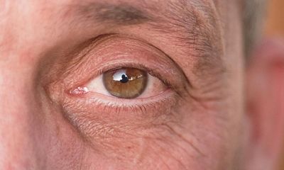 Blinking fools? The men who think shaving off their eyelashes will make them more masculine
