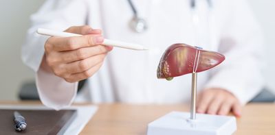 A promising new approach to treating potentially deadly liver disease