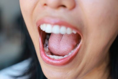 Scientists just mapped your tongue. It may be the key to helping you lose weight