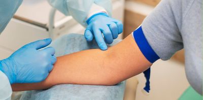 What is a blood cholesterol ratio? And what should yours be?