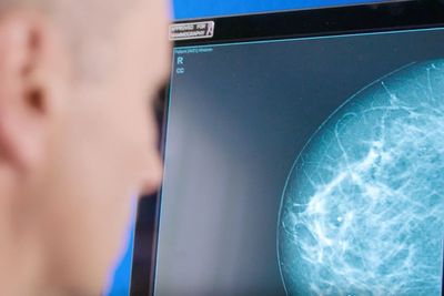 Having children later and being overweight ‘increases risk of breast cancer’