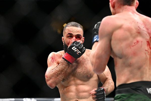 Belal Muhammad’s UFC 315 injuries made clear in gruesome photos