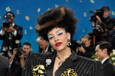 Doja Cat explains plastic surgery issue she begs fans not to notice