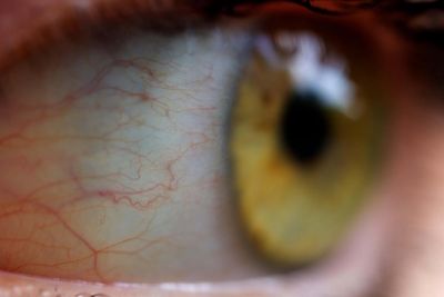 Nationwide eye care product recall as experts warn to stop using this product immediately
