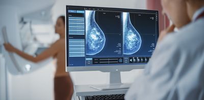 How breast tissue density affects your risk of breast cancer