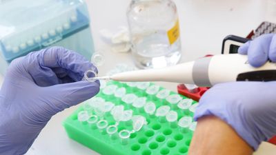 Industry must step up to fund research: Shorten