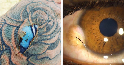 93 Moments When Medicine Crossed Into The Uncanny