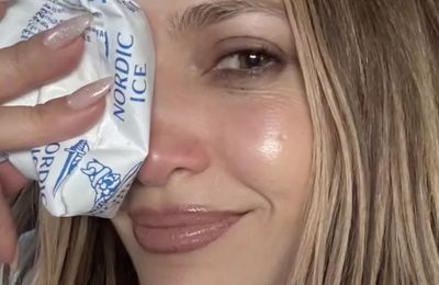 Jennifer Lopez suffers cut and black eye in American Music Awards rehearsals