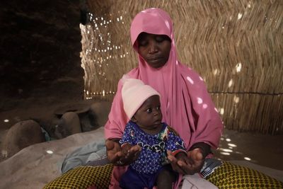 AP PHOTOS: Children die as USAID aid cuts snap a lifeline for the world's most malnourished