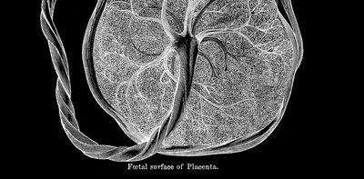 Placenta bandages have far more health benefits than risky placenta pills − a bioengineer explains