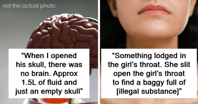 47 Autopsy Experts Reveal Their Weirdest And Most Unique Finds: “There Was No Brain”