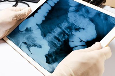 The ick factor that could save a life: US cancer researchers look to fecal waste for treatment clues