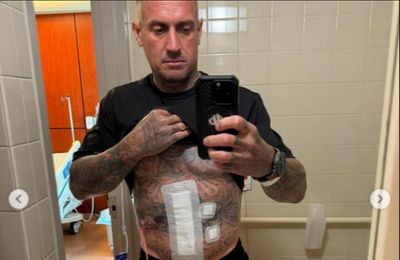 Carey Hart injured in motocross training accident