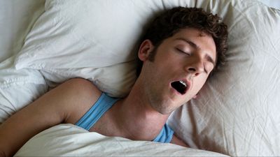 Sleep apnea: What is it, what’s the cause and how to tackle it