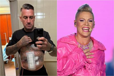 Carey Hart apologizes to wife Pink as he shows off gruesome motocross injury