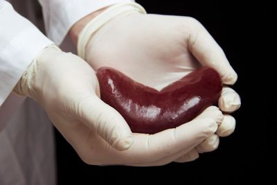 Why Your Organ Donation May Not Go Where You Think It Does