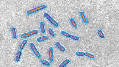 Hospital superbug can feed on medical plastic, first-of-its-kind study reveals