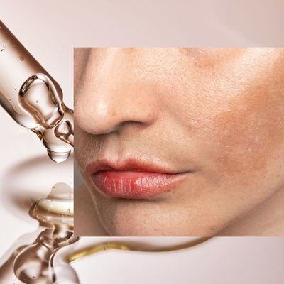 How to Treat Melasma Effectively, According to Top Dermatologists