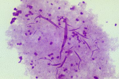 World-first gonorrhoea vaccine offered on NHS to combat rise in super strain STI