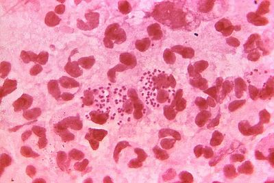 Who can access the new world-first STI vaccine