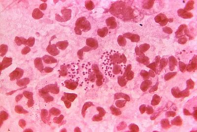 What is the gonorrhoea vaccine and when will it be rolled out?