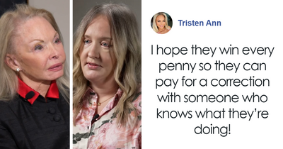 Women Who “Wanted To Look A Little Refreshed” Show How A Plastic Surgeon “Disfigured” Them