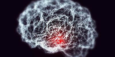 The TGA has approved donanemab for Alzheimer’s disease. How does this drug work and who will be able to access it?
