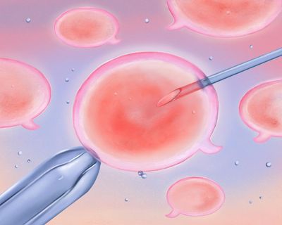 What to say – and what not to say – to friends, or colleagues having IVF